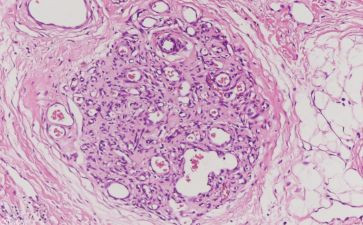 2024病理科工作总结精选8篇