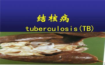 结核防治日宣传总结8篇